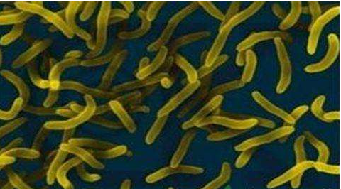 微生物菌劑好？好在哪里您知道嗎？